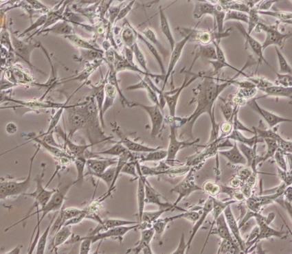 Paola Nitti (UNIGE) U87 cells: Species: HUMAN ASTROCYTOMA Derived from brain of a male 44 years