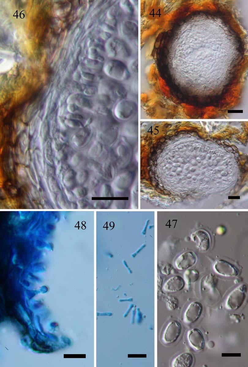 Mycosphere Figs 44 49 Phyllosticta state of G. bispora (MFLU 10 0464, holotype).