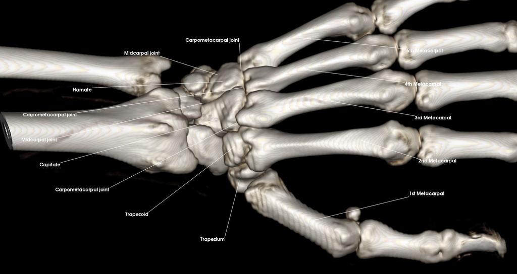 6: Hand Name the bones and joints in the hand 1st-5th