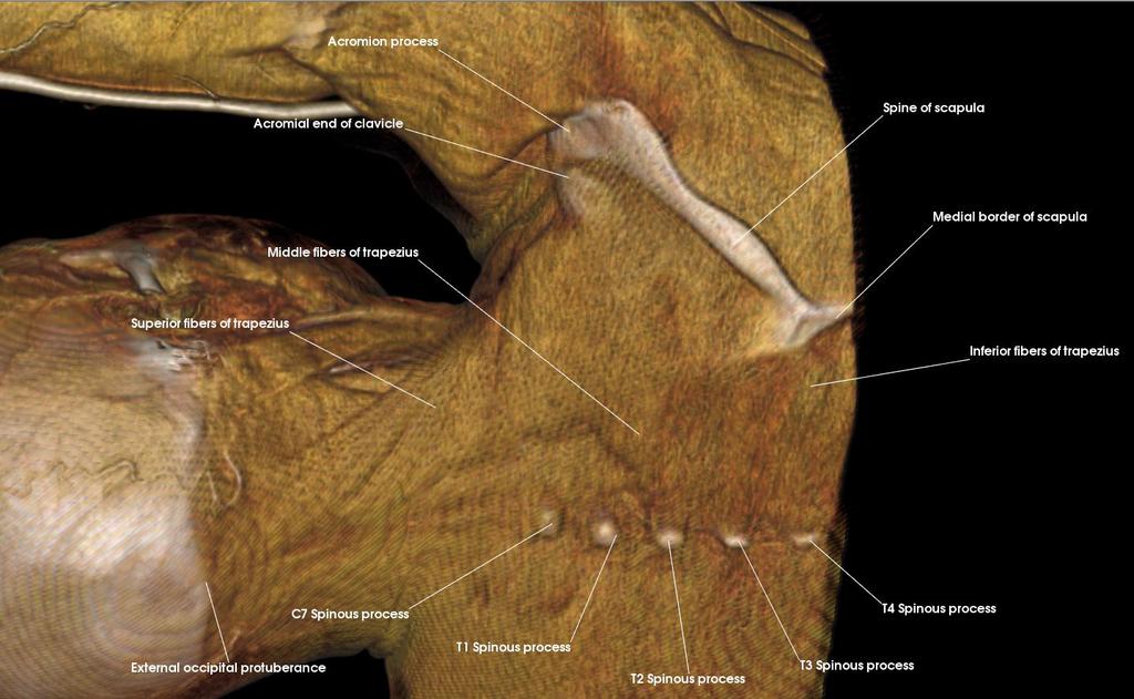 2: Posterior Axioappendicular Muscles Identify and describe the sites of attachment for the extrinsic muscles of the back Review the associated actions of these