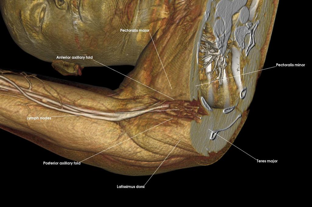 tuberosity Middle fibers of deltoid Posterior fibers of deltoid Spine of scapula 3. a.