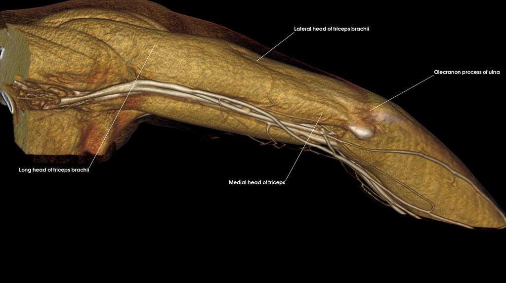 Posterior Compartment of Arm (Lateral) Lateral head of