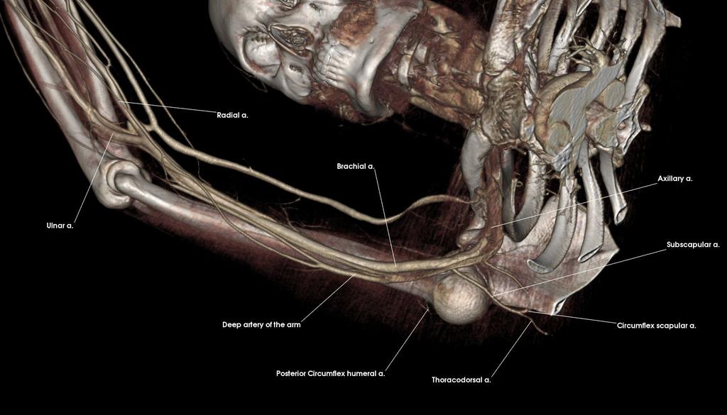 Brachial a. Circumflex scapular a. Deep artery of the arm Posterior circumflex humeral a.