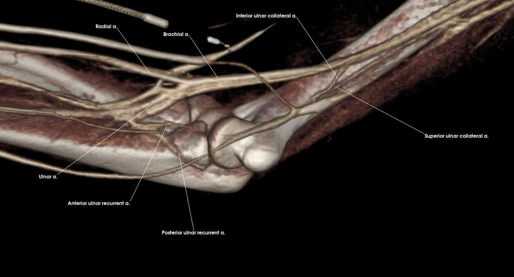 Brachial a. Inferior ulnar collateral a. Posterior ulnar recurrent a. Radial a.