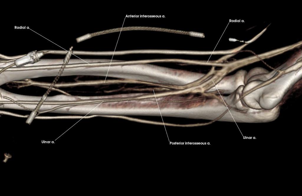 Anterior interosseous a. Posterior interosseous a. Radial a.