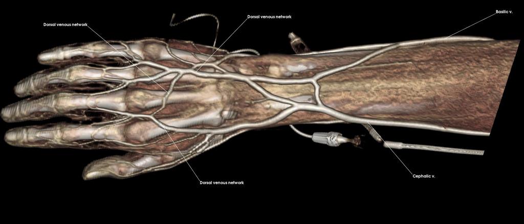 and Deep Arch (Lateral) 3: Venous Return of the Upper Limb Describe the