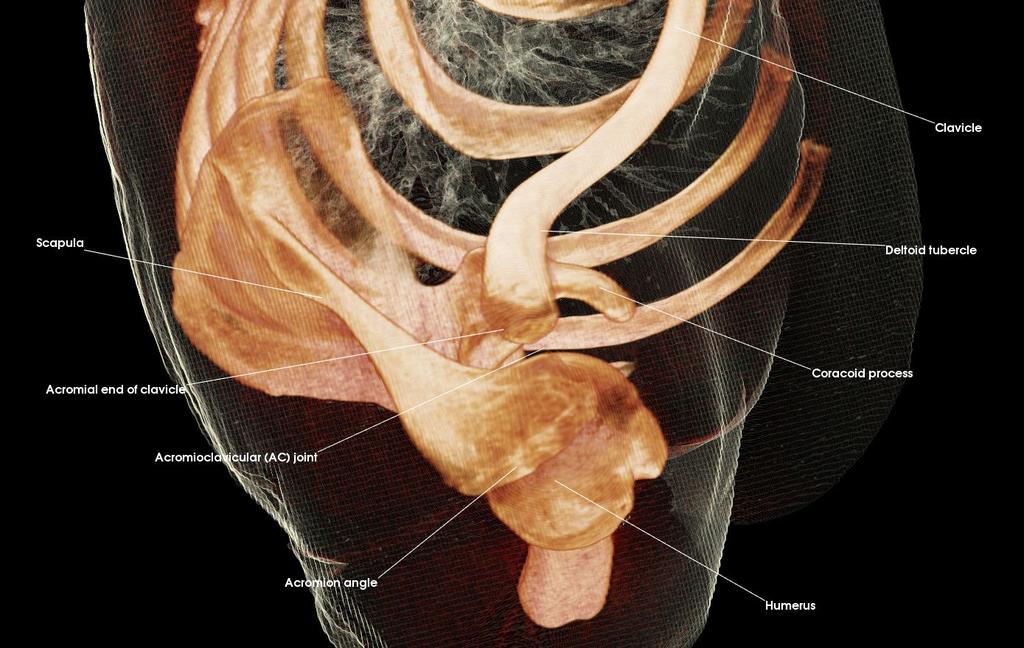 avicle Sternoclavicular (SC) joint 1. c.