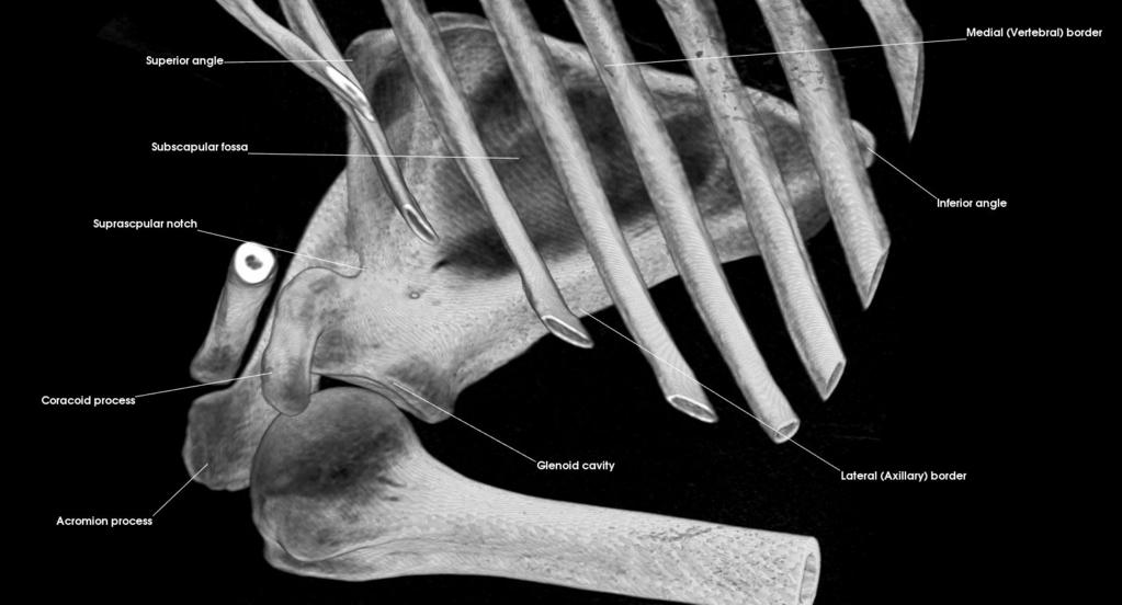 2: Scapula Describe the features of the scapula and list the various processes and fossa Acromion process Coracoid
