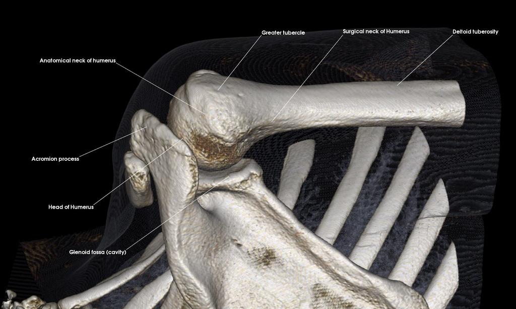 Intertubercular Groove (Anterior) Acromion process Anatomical neck of humerus Deltoid