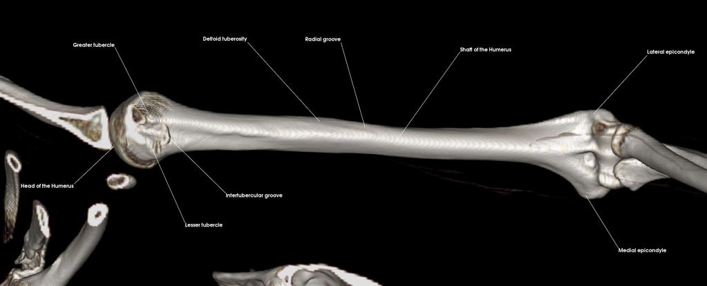 4: Distal Humerus and Elbow Classify the elbow joint and identify the sites of articulation between the various bones