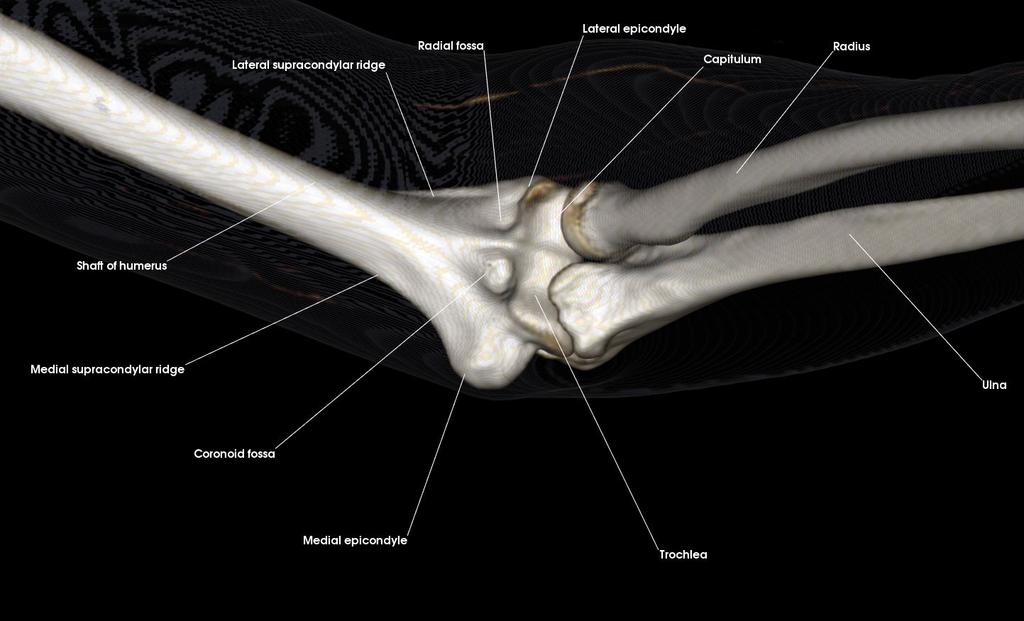 epicondyle Radial groove Shaft of the humerus 4. a.