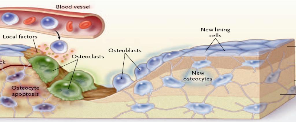 Bone Metabolism: A Balance Between Osteoblasts and Osteoclasts