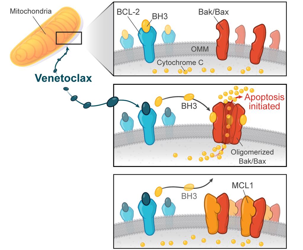 MCL1: The Achilles Heal for Venetoclax Venetoclax inhibits BCL2 but not antiapoptotic family member MCL1