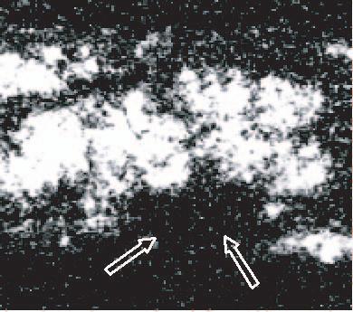 Carlson, Slominski, Linette, Mihm & Ross Figure 2A. in situ hybridization image using a radiolabeled MLSN-1 probe and dark-field illumination.