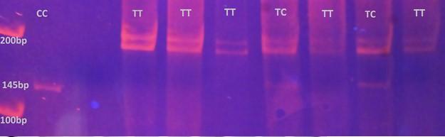 Materijal i metode Slika IV-3 Prikaz TT, TC i CC genotipova na PAA gelu. Prikazane linije odgovaraju veličini od 200bp i 145bp.