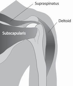 Shoulder Pain Rehabilitation Protocol Rotator Cuff Syndrome Shoulder impingement The Resistance Chair Solution Shoulder Impingement a.