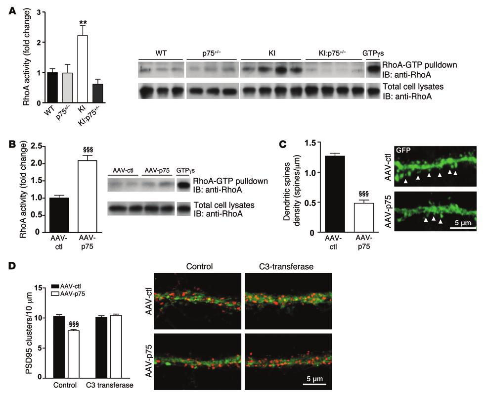 The Journal of Clinical Investigation Figure 10. Increased RhoA activity contributes to p75 NTR -mediated dendritic spine loss in mutant KI mice.