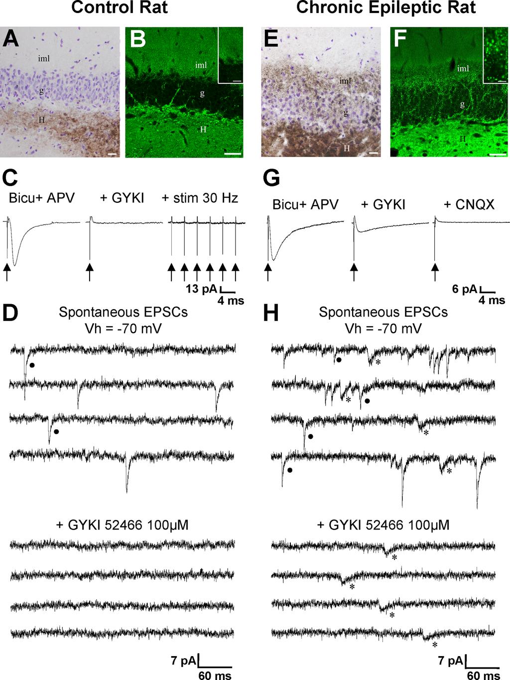 Epsztein et al. EPSCKA in Epileptic Granule Cells J. Neurosci.