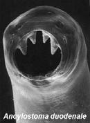 Taxonomic Relationships of the Helminth Parasites Parasitic Helminths Introduction to the helminth parasites BVM&S Parasitology Tudor W Jones Platyhelminthes "Flatworms" Trematodes "Flukes"