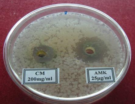 Table: 2 Antibacterial activity of Cucurbita maxima seed extract Zone of