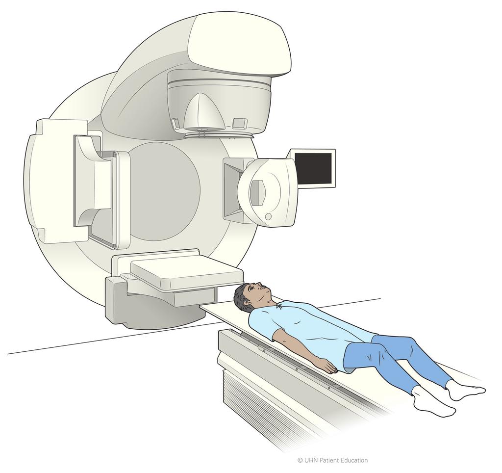 Radiation Treatment Whole Brain Radiation Whole brain radiation treatment is treatment with x-rays given to you with a machine (linear accelerator) that directs radiation to the whole