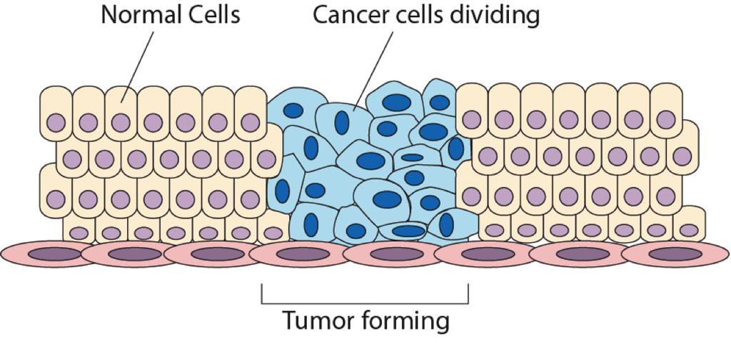 in the G 0 phase. The result can be a mass of cells that known as a tumor. Some tumors may show unregulated growth, but they do not spread to other parts of the body.