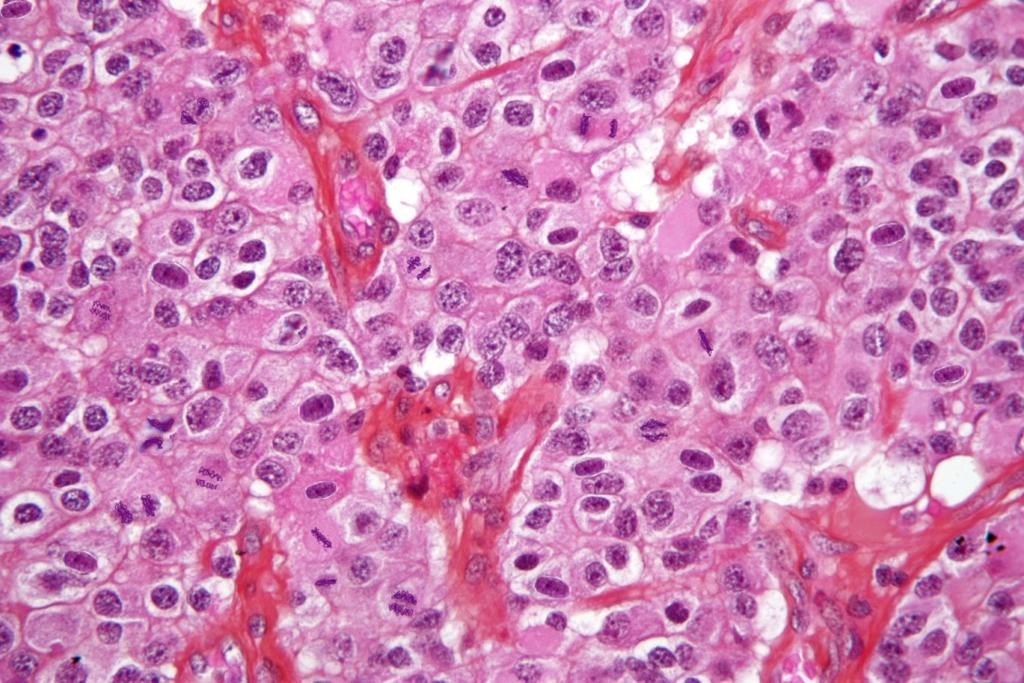Normal Tissue vs. Cancerous Tissue A. Normal Tissue B.