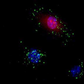 -knockdown cells expressed Dsred (red). (b) WPBs stained with an anti-vwf antibody (green) and nuclei co-stained with DAPI (blue).