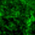 (green) in the presence of forskolin were imaged with a spinning-disk
