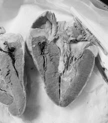 Dissection of the Heart (2 possible cuts) Incision through each of the chambers, two longitudinal cuts. 2.