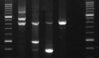 Detection of typical and rare BCR-ABL transcripts by multiplex PCR M e19a2 SD1 e1a2 K562 b3a2