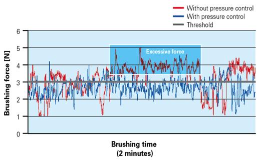 Janusz K et al. Impact of a novel power toothbrush with SmartGuide Technology on brushing pressure and thoroughness. Journal of Contemporary Dental Practice. 2008; 9(7):1 13.