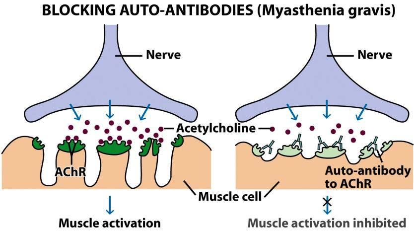 Blocking Antibodies- Human
