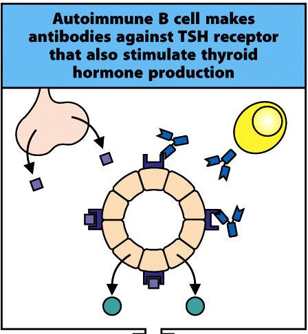 Stimulating Antibodies Human Disease Grave s Disease Some autoantibodies can bind