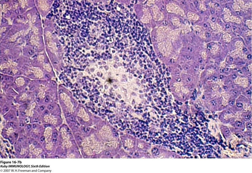 Pancreas of a NOD mouse with autoimmune