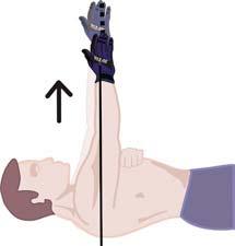 Protraction: Supine Attach: Back of wrist. Action: Begin Thumb-Up, Arm at your straight out in front.