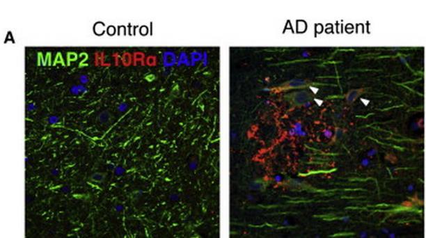 IL-10 Signaling Is Elevated in AD Patient Brains IL10Rα (red) and MAP-2 (green) labeling in hippocampal sections Representative microphotographs of thioflavin S + amyloid plaques (green), MAP-2