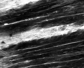 Cardiac Tissue Oil 50 µm