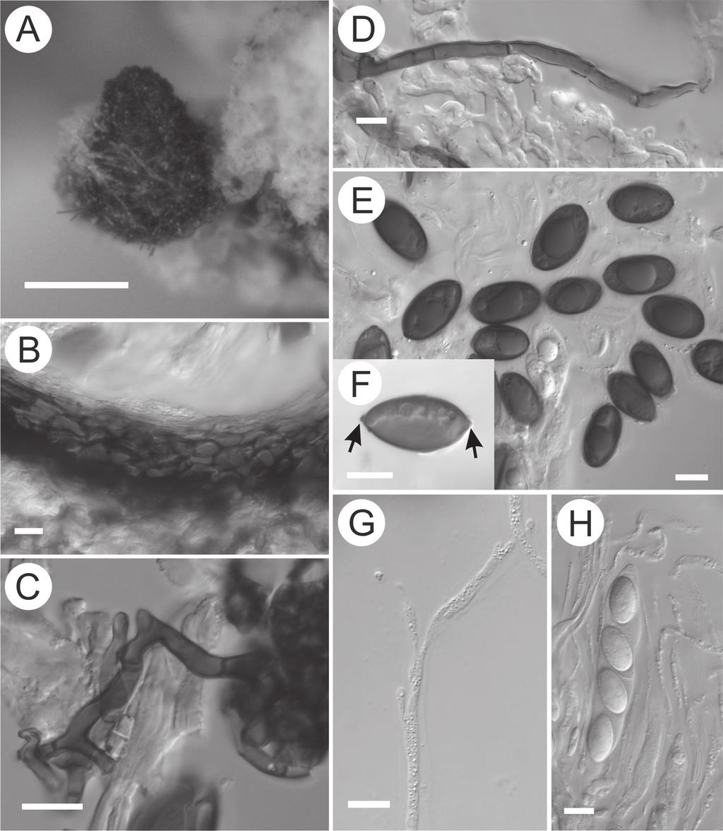 326... Zhurbenko, Kukwa & Oset Plate 1. Roselliniella stereocaulorum.