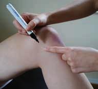 Note: The exam starts with the healthy knee to allow the patient to become used to the procedure. 1. Marking the joint line The patient is positioned supine on the examination table.