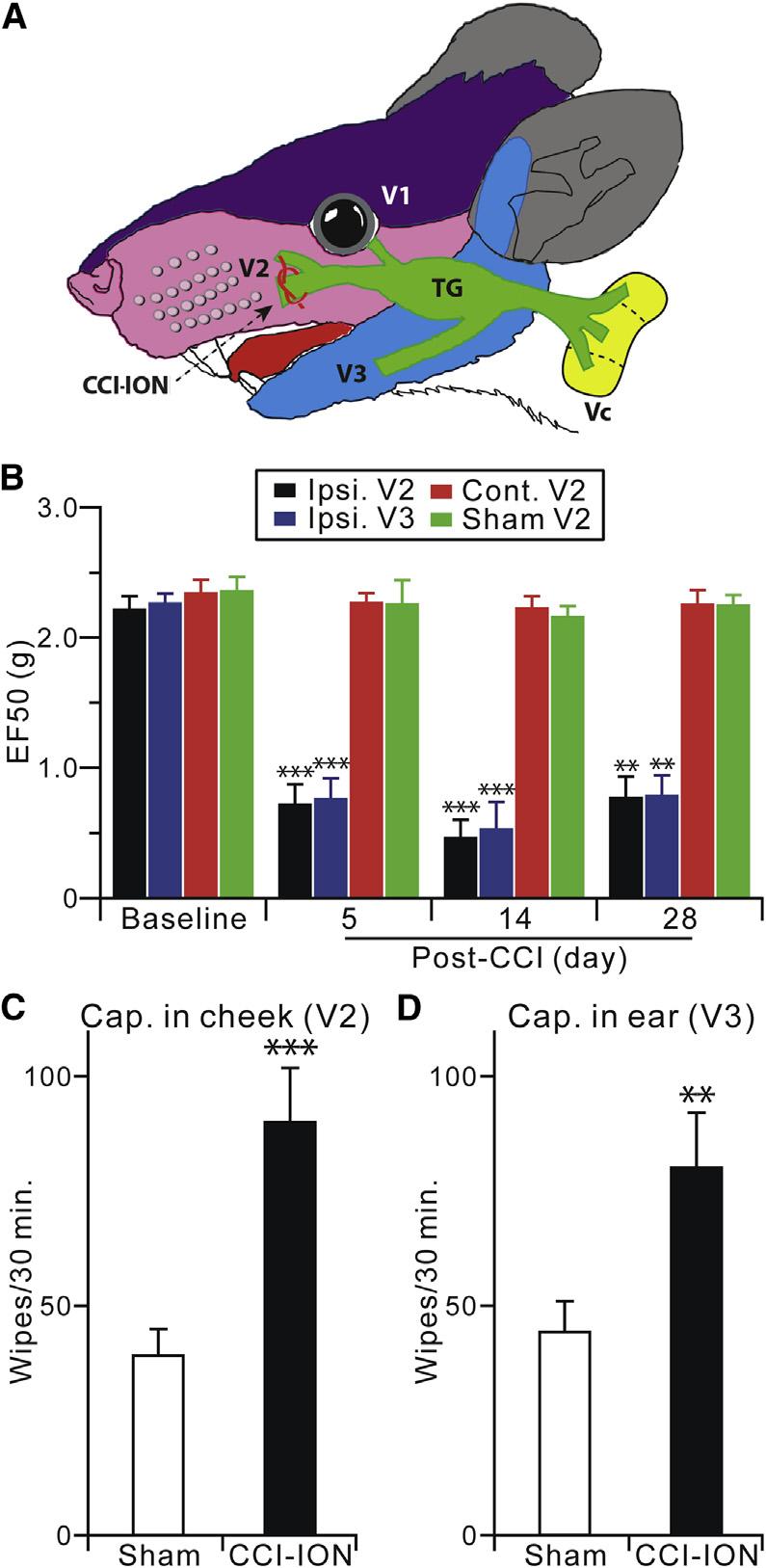 pain mechanism in which descending 5-HT from the RVM maintains central terminal sensitization by activation of presynaptic 5-HT3A receptors and subsequent facilitation of TRPV1 activity.