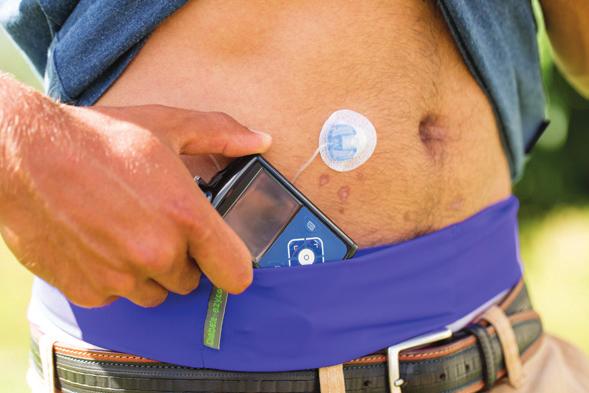 INSULIN PUMP THERAPY CHANGING LIVES TODAY Have you just been diagnosed with insulin dependent diabetes? Perhaps you ve been on multiple daily injection therapy for years?