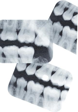 for dentists to obtain full-mouth series of radiographs at the beginning of a patient s care and to repeat this at 3- to 5-year intervals thereafter.