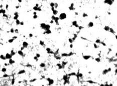 analysis (F) of a microglia migration