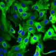 fter transfection, - or -treated astrocytes