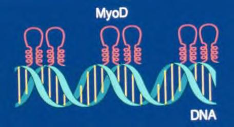 RMS diagnosis: MyoD and myogenin Transcription factors that bind DNA and initiate myogenesis