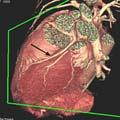 Can provide image of the full heart volume (15x15x15cm) 1.