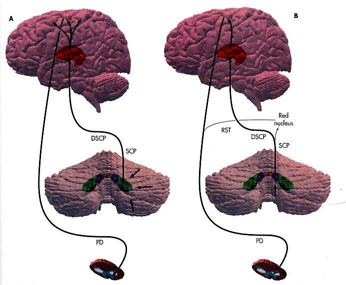 Principal Cerebellar - Cortical Relationship Per caption: principal circuit by which deep