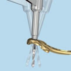 (2) Alternatively, use the freehand VA-LCP drill sleeve and insert it fully into the VA locking hole.