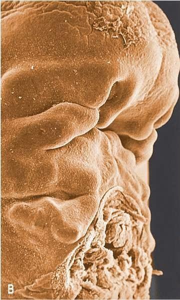 human embryo stage
